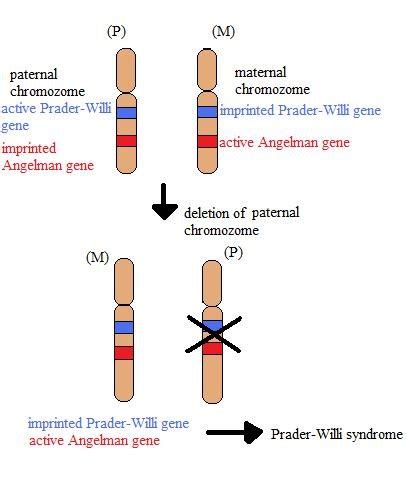 epimutation imprinting prada willi|Chromosome 15 Imprinting Disorders: Genetic Laboratory .